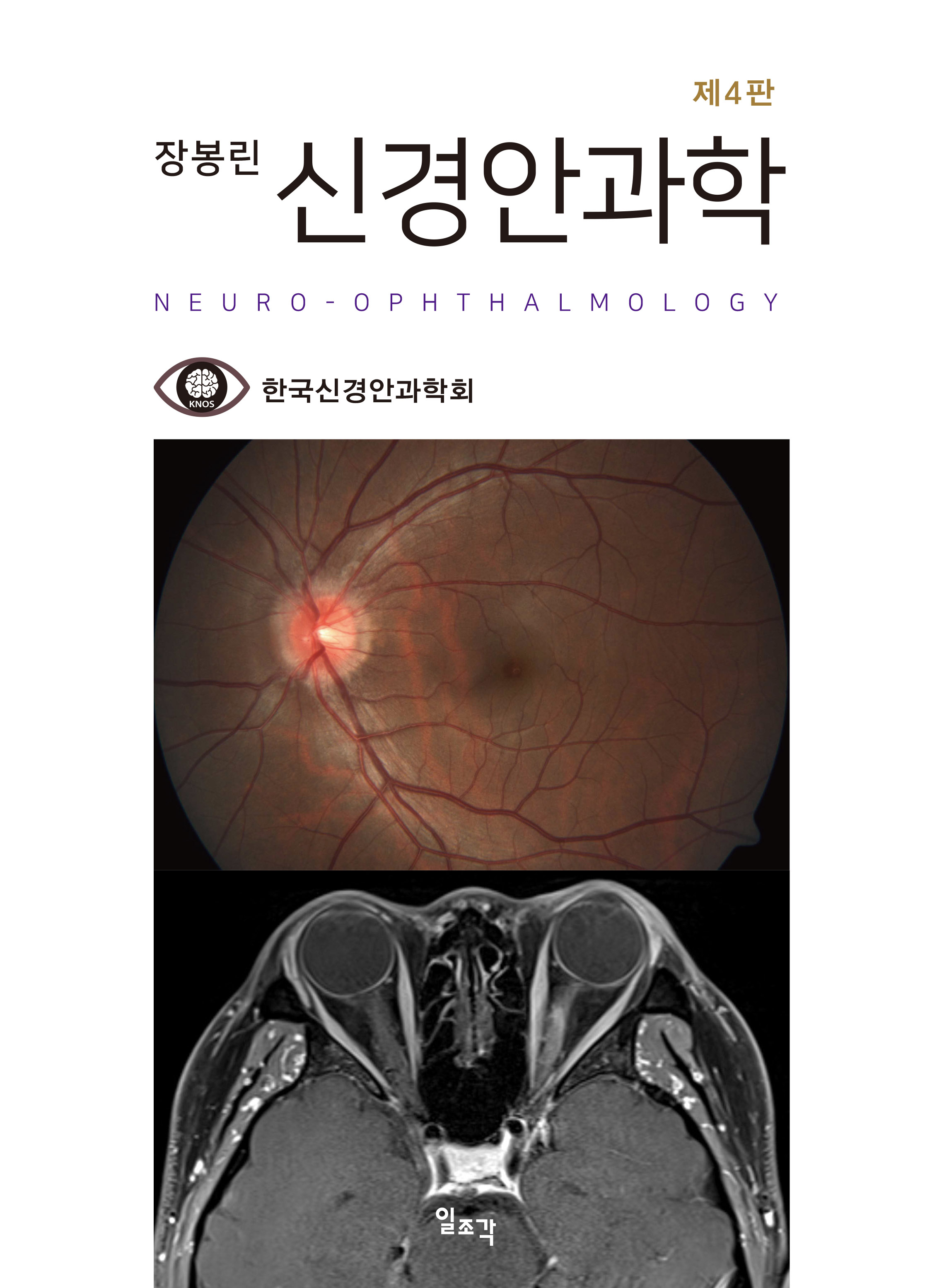 제4판 장봉린 신경안과학